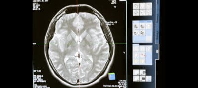 MRI brain scan highlighting neural activity and brain structure.